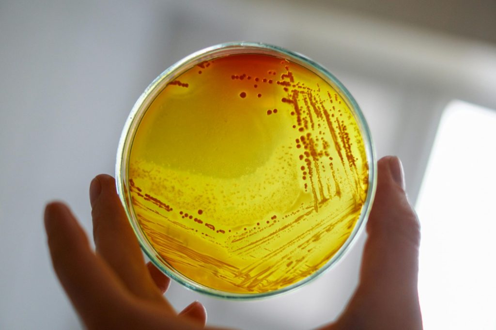 Wat is legionella precies?
